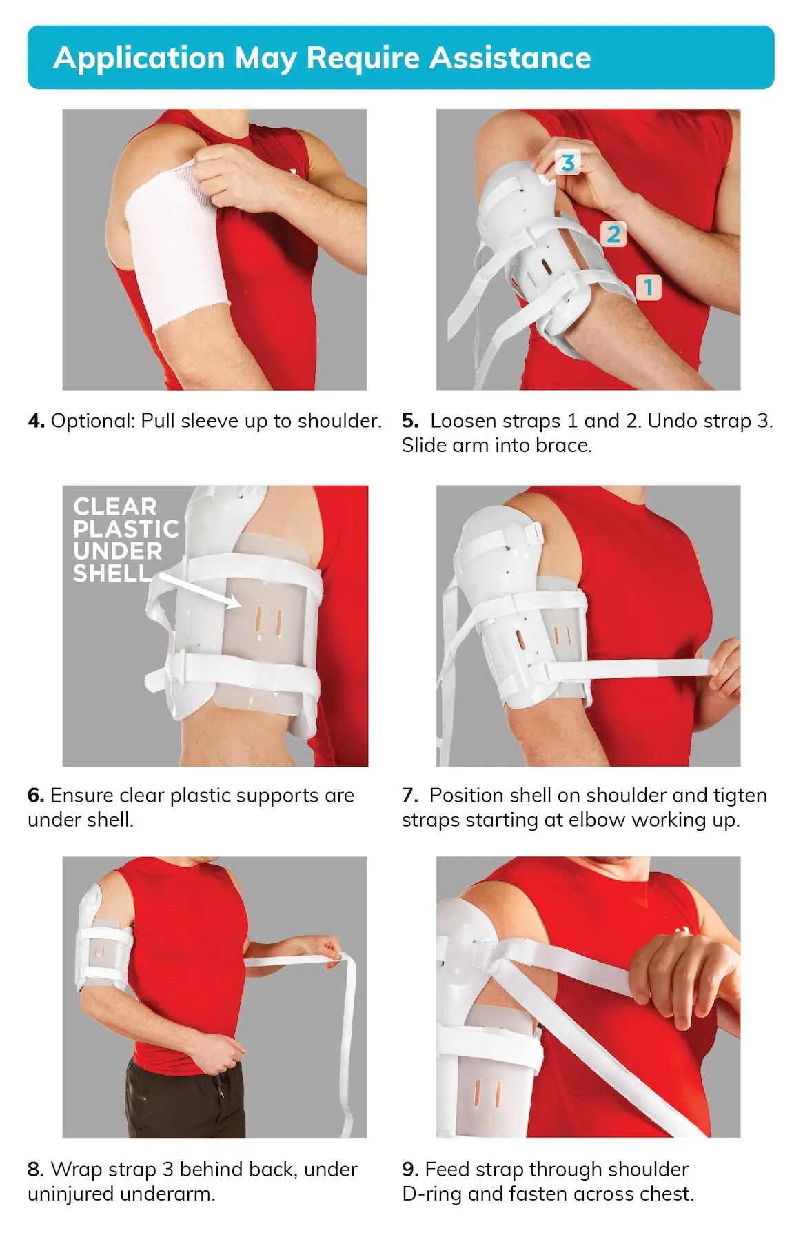 Sarmiento Brace | Humeral Fracture Splint and Upper Arm Support for Broken Humerus